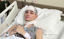 Tokat’ta Otel Yangınında Ağır Yaralanan Genç, Ölüm Haberlerini Gülerek Anlattı